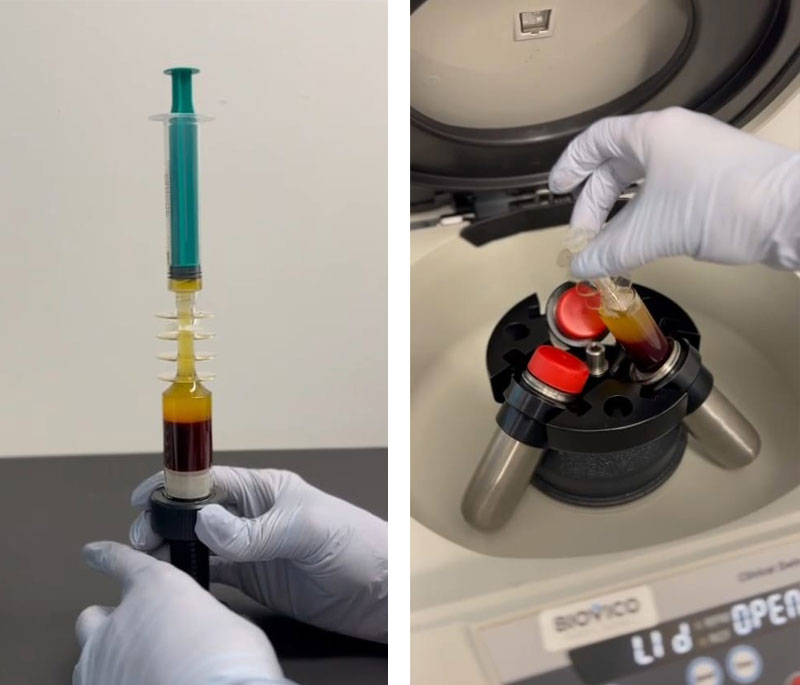 Medycyna Estetyczna Lublin fibryna lublin